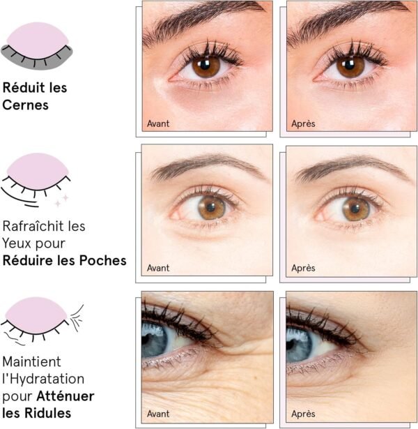 Grace & Stella [24 Paires, Or] Patch en Gel qui Réduit les Cernes Sous les Yeux, Anti Rides, Anti Poche - Vegan & Cruelty-Free, Soins des Yeux – Image 3