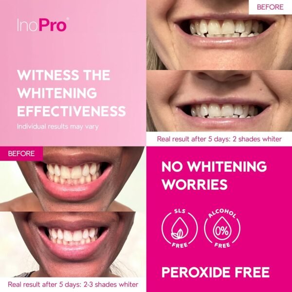 InoPro Green Teeth Whitening Strips - Peroxide Free Whitening Strips - Whitening Without The Harm - Deep Stains Removal - Sensitivity Free - 14 traitements, 28 Strips – Image 3